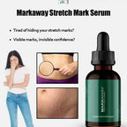 Markaway Stretch Mark Serum 30ml – Herbal Hydration & Skin Tone Repair