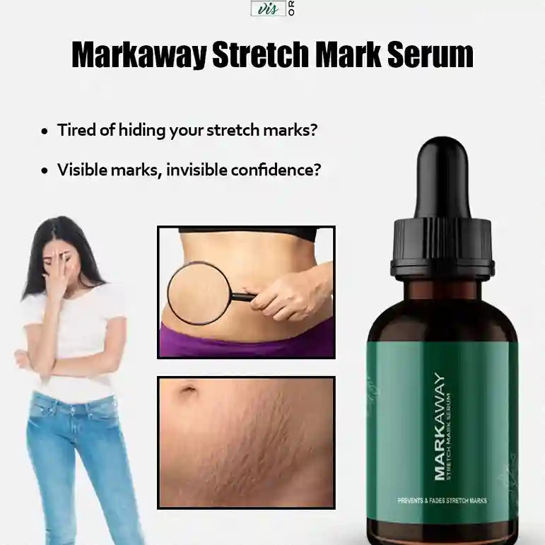 Markaway Stretch Mark Serum 30ml – Herbal Hydration & Skin Tone Repair