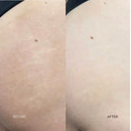 Markaway Stretch Mark Serum 30ml – Herbal Hydration & Skin Tone Repair