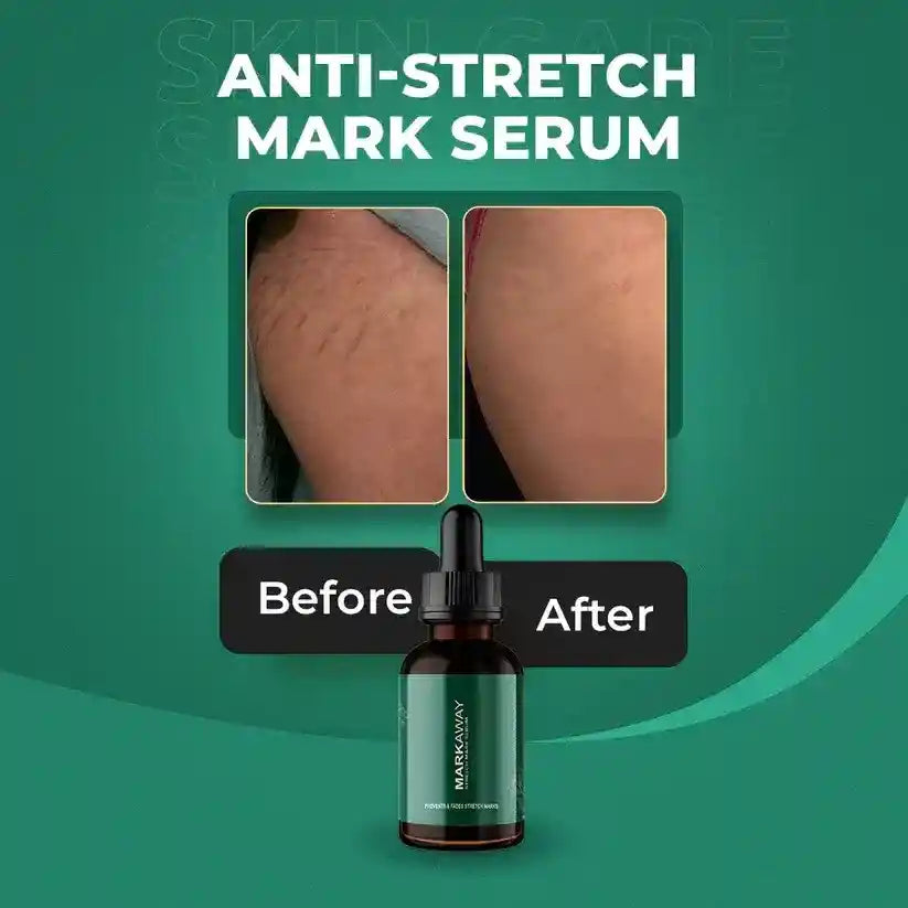 Markaway Stretch Mark Serum 30ml – Herbal Hydration & Skin Tone Repair