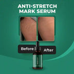 Markaway Stretch Mark Serum 30ml – Herbal Hydration & Skin Tone Repair